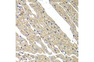 Immunohistochemistry of paraffin-embedded rat heart using SGCD antibody at dilution of 1:100 (x40 lens). (SGCD antibody)