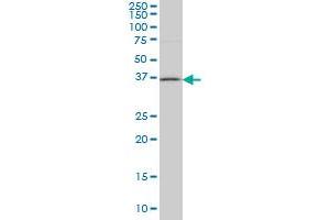 HSD17B1 monoclonal antibody (M03A), clone 2E5 Western Blot analysis of HSD17B1 expression in Jurkat . (HSD17B1 antibody  (AA 189-285))