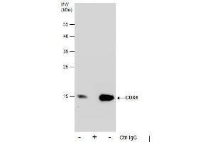 IP Image Immunoprecipitation of COX4 protein from 293T whole cell extracts using 5 μg of COX4 antibody, Western blot analysis was performed using COX4 antibody, EasyBlot anti-Rabbit IgG  was used as a secondary reagent. (COX IV antibody  (Center))