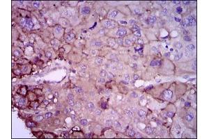 Immunohistochemistry (IHC) image for anti-RAB4A, Member RAS Oncogene Family (RAB4A) antibody (ABIN969558)