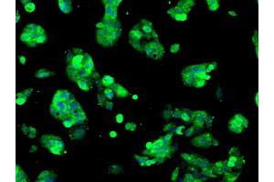 Anti-SORD mouse monoclonal antibody (ABIN2453676) immunofluorescent staining of COS7 cells transiently transfected by pCMV6-ENTRY SORD (RC200415). (SORD antibody)