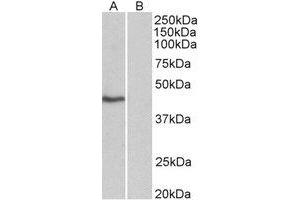 Western Blotting (WB) image for anti-TATA Box Binding Protein (TBP) (N-Term) antibody (ABIN2465061) (TBP antibody  (N-Term))