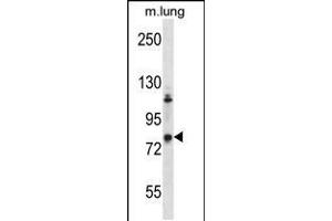 Western blot analysis in mouse lung tissue lysates (35ug/lane). (ADRBK2 antibody  (C-Term))