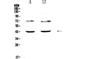 Western blot analysis of TSPAN12 using anti-TSPAN12 antibody . (TSPAN12 antibody  (AA 111-224))