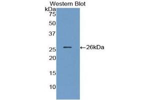 Detection of Recombinant ANGPT1, Human using Polyclonal Antibody to Angiopoietin 1 (ANGPT1) (Angiopoietin 1 antibody  (AA 21-228))