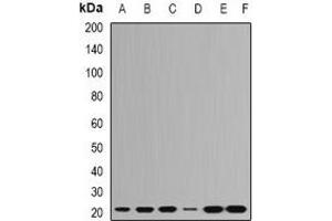 Western blot analysis of RPL9 expression in Hela (A), HepG2 (B), SHSY5Y (C), Jurkat (D), mouse brain (E), mouse spleen (F) whole cell lysates. (RPL9 antibody)