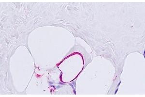 Human, Adipocyte: Formalin-Fixed Paraffin-Embedded (FFPE) (Glucagon Receptor antibody  (N-Term))