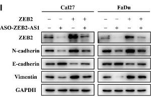 Western Blotting (WB) image for anti-Vimentin (VIM) antibody (ABIN2854814)