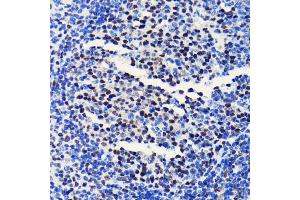 Immunohistochemistry of paraffin-embedded mouse spleen using BRG1/SM antibody (ABIN7270655) at dilution of 1:100 (40x lens). (SMARCA4 antibody)