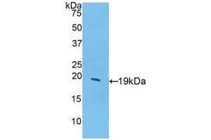 Detection of Recombinant GCSF, Porcine using Polyclonal Antibody to Colony Stimulating Factor 3, Granulocyte (GCSF) (G-CSF antibody  (AA 34-193))