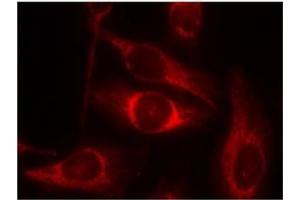 Image no. 2 for anti-Tumor Protein P53 (TP53) (pSer46) antibody (ABIN196786) (p53 antibody  (pSer46))