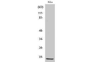 Western Blotting (WB) image for anti-Cyclin-Dependent Kinase Inhibitor 2B (p15, Inhibits CDK4) (CDKN2B) (C-Term) antibody (ABIN3176700) (CDKN2B antibody  (C-Term))