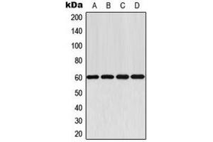 Western blot analysis of AKT expression in MCF7 (A), mouse lung (B), rat heart (C), rat brain (D) whole cell lysates. (AKT1 antibody  (C-Term))
