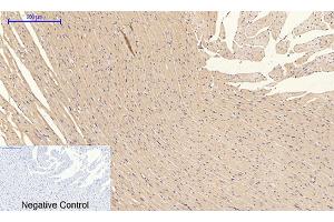 Immunohistochemical analysis of paraffin-embedded rat heart tissue. (PI3K p85/p55 antibody  (pTyr199, pTyr467))