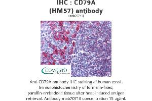 Image no. 1 for anti-B-cell antigen receptor complex-associated protein alpha chain (CD79A) (AA 202-216) antibody (ABIN1723567) (CD79a antibody  (AA 202-216))