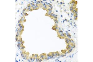 Immunohistochemistry of paraffin-embedded mouse lung using WNT5B antibody. (WNT5B antibody)