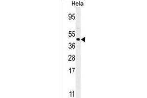 Western Blotting (WB) image for anti-Forkhead Box L2 (FOXL2) antibody (ABIN2995546) (FOXL2 antibody)