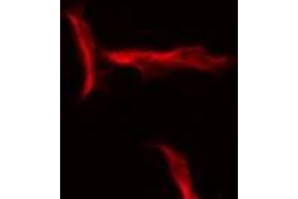 SERPINB12 antibody  (N-Term)