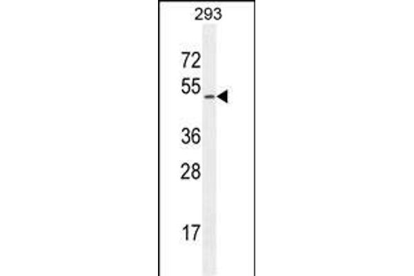 CHRDL1 antibody  (N-Term)