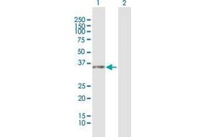 Lane 1: GLB1L3 transfected lysate ( 35. (FLJ90231 293T Cell Transient Overexpression Lysate(Denatured))