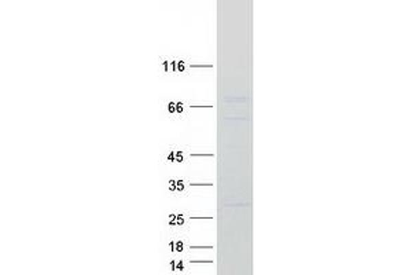 CNOT4 Protein (Transcript Variant 2) (Myc-DYKDDDDK Tag)