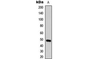 Western blot analysis of ECHOS1 expression in A431 (A) whole cell lysates. (TMPRSS3 antibody  (C-Term))