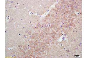 Formalin-fixed and paraffin embedded rat brain labeled with Rabbit Anti KIFC1 Polyclonal Antibody, Unconjugated (ABIN873143) at 1:200 followed by conjugation to the secondary antibody and DAB staining (KIFC1 antibody)