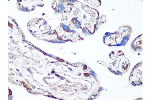 Immunohistochemistry of paraffin-embedded human placenta using MAPK14 antibody (ABIN6291833) at dilution of 1:100 (40x lens). (MAPK14 antibody)