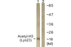 Western Blotting (WB) image for anti-Histone 3 (H3) (H3K23ac) antibody (ABIN2890731) (Histone 3 antibody  (H3K23ac))