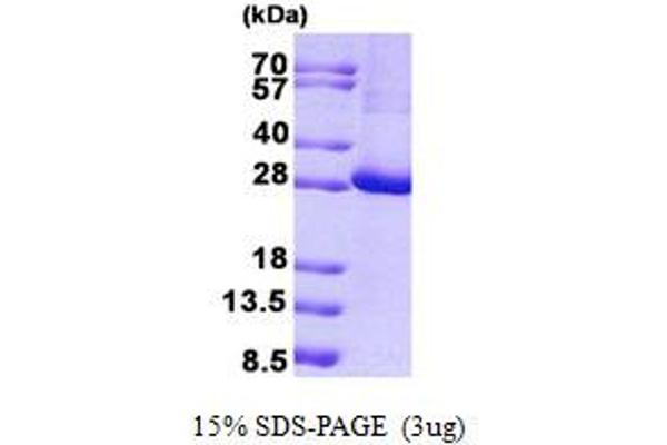 KCTD11 Protein (His tag)