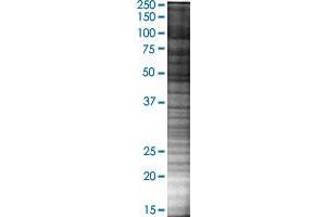 Western Blotting (WB) image for UCP2 293T Cell Transient Overexpression Lysate(Denatured) (ABIN1333848)