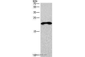 Western blot analysis of Mouse skeletal muscle tissue, using TNFRSF17 Polyclonal Antibody at dilution of 1:200 (BCMA antibody)