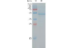 Human RHOC(1-189) Protein, hFc Tag on SDS-PAGE under reducing condition. (RHOC Protein (AA 1-189) (Fc Tag))