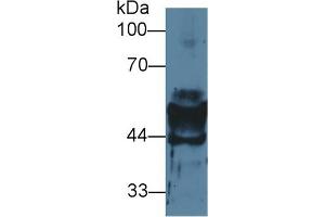 Western blot analysis of Mouse Stomach lysate, using Mouse KRT14 Antibody (2 µg/ml) and HRP-conjugated Goat Anti-Rabbit antibody ( (KRT14 antibody  (AA 1-484))