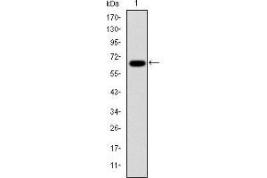 Western Blotting (WB) image for anti-Proteasome (Prosome, Macropain) Subunit, beta Type, 8 (Large Multifunctional Peptidase 7) (PSMB8) antibody (ABIN969371)