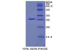 SDS-PAGE analysis of Rat FGFRL1 Protein. (FGFRL1 Protein)