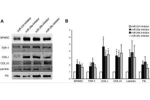 Western Blotting (WB) image for 10X TTBS (pH 7.5) (ABIN925553)