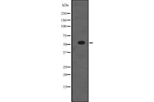 Western blot analysis of NR5A1 expression in HEK293 cells ,The lane on the left is treated with the antigen-specific peptide. (NR5A1 antibody  (Internal Region))