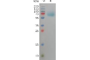 Human F Protein, His Tag on SDS-PAGE under reducing condition. (FGFR3 Protein (AA 23-375) (His tag))