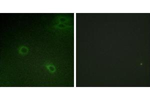 P-peptide - + (CXCR4 antibody  (pSer339))