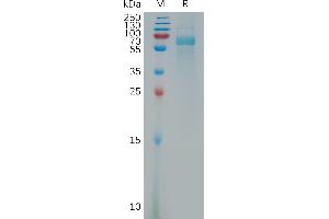 VPS4A Protein (AA 1-437) (His tag)
