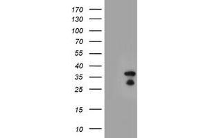 Western Blotting (WB) image for anti-Hes Family bHLH Transcription Factor 1 (HES1) antibody (ABIN1498633) (HES1 antibody)