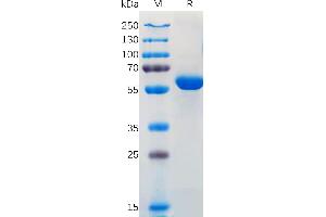 SARS-CoV-2 (2019-nCoV) S protein RBD(L452R& E484Q), hFc Tag on SDS-PAGE under reducing condition. (SARS-CoV-2 Spike Protein (B.1.617.1 - kappa, RBD) (Fc Tag))