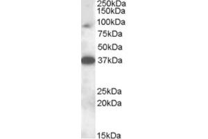 Western Blotting (WB) image for anti-Membrane-Associated Ring Finger (C3HC4) 10, E3 Ubiquitin Protein Ligase (MARCH10) (Internal Region) antibody (ABIN2466780) (MARCH10 antibody  (Internal Region))