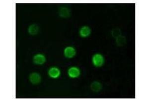 Immunofluorescence analysis of B lymphocytes using CD20 antibody. (CD20 antibody)