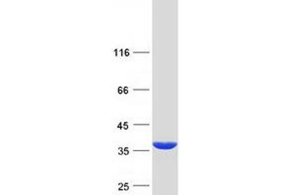 PECR Protein (Myc-DYKDDDDK Tag)