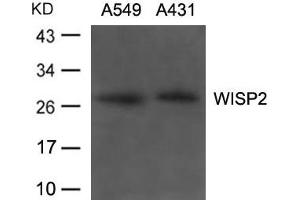 Western blot analysis of extracts from A549, A431 cells using WISP2 Antibody. (WISP2 antibody)