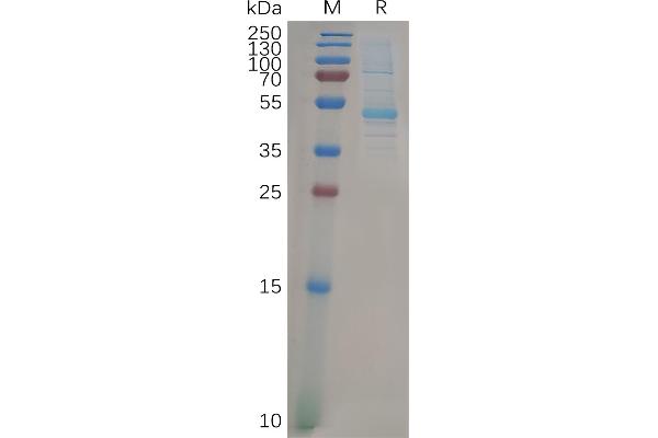 K-RAS Protein (AA 2-185) (mFc Tag)