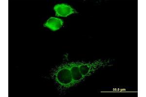 Immunofluorescence of purified MaxPab antibody to SLC16A1 on HeLa cell. (SLC16A1 antibody  (AA 1-500))