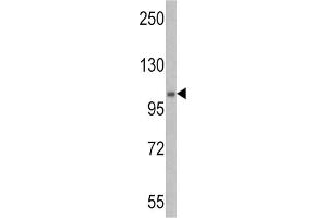 Western Blotting (WB) image for anti-E1 Ubiquitin antibody (ABIN3001449) (E1 Ubiquitin antibody)